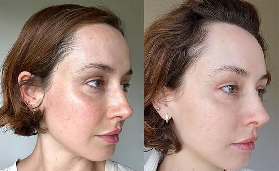 Glutathione / Retinol Serum ( On Back Order) Ships in 1 week !